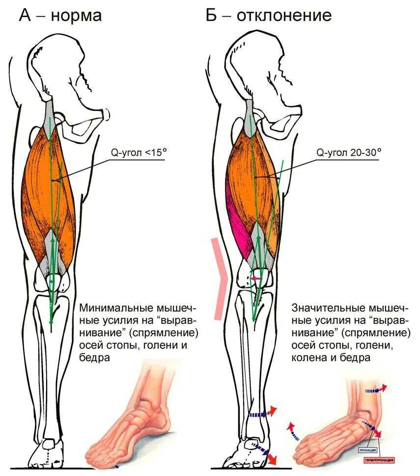 Ноги выше колена. Синдром бегуна колено илиотибиального тракта. Илиотибиальный тракт коленного сустава. Синдром трения илиотибиального тракта.