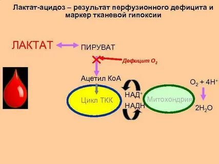 Что такое лактоацидоз