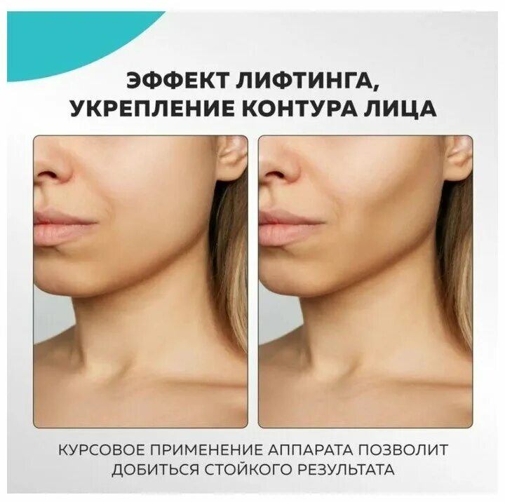 Biolift m101 gezatone отзывы