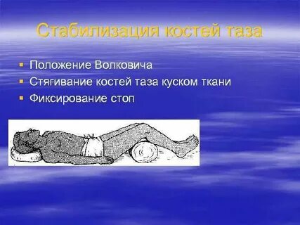 Положение костей