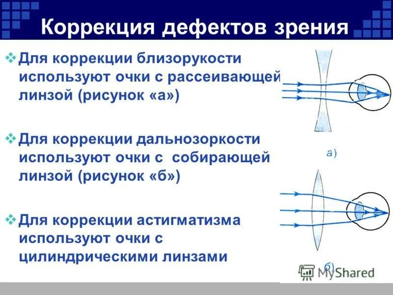 Коррекция зрения с помощью линз. Дефекты зрения дальнозоркость и близорукость и их коррекция. Оптическая коррекция близорукости. Способы коррекции близорукости и дальнозоркости. Коррекция близорукости и дальнозоркости с помощью линз.