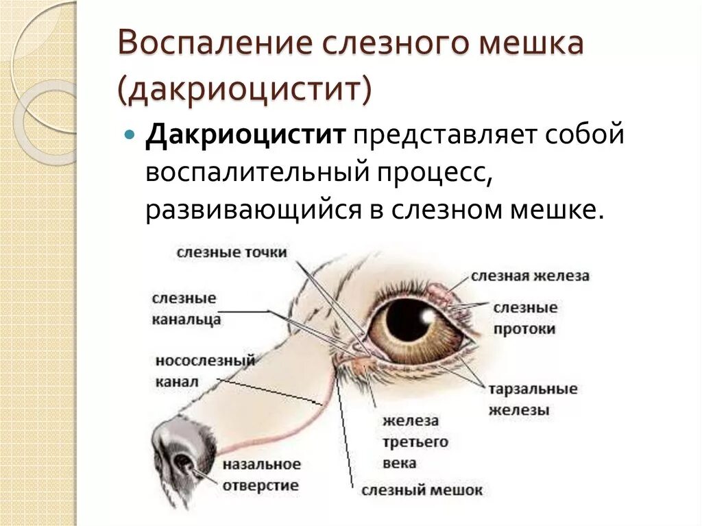 Слезная железа у собак. Слезный мешок васпален. Воспаление слезного аппарата. Воспаление слезного канала. Воспаление слезного мешка (дакриоцистит).