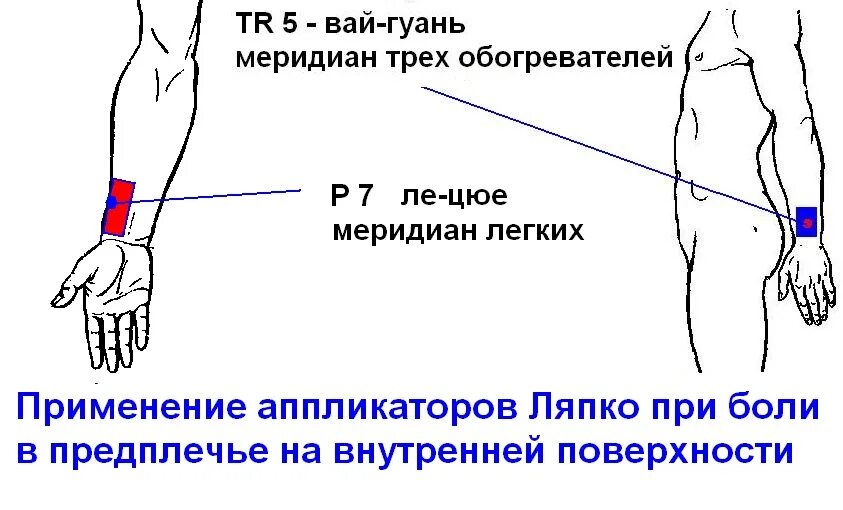 Стороны предплечья. Внутренняя поверхность предплечья. Средняя треть внутренней поверхности предплечья. Внешняя часть предплечья. Болит предплечье правой руки.