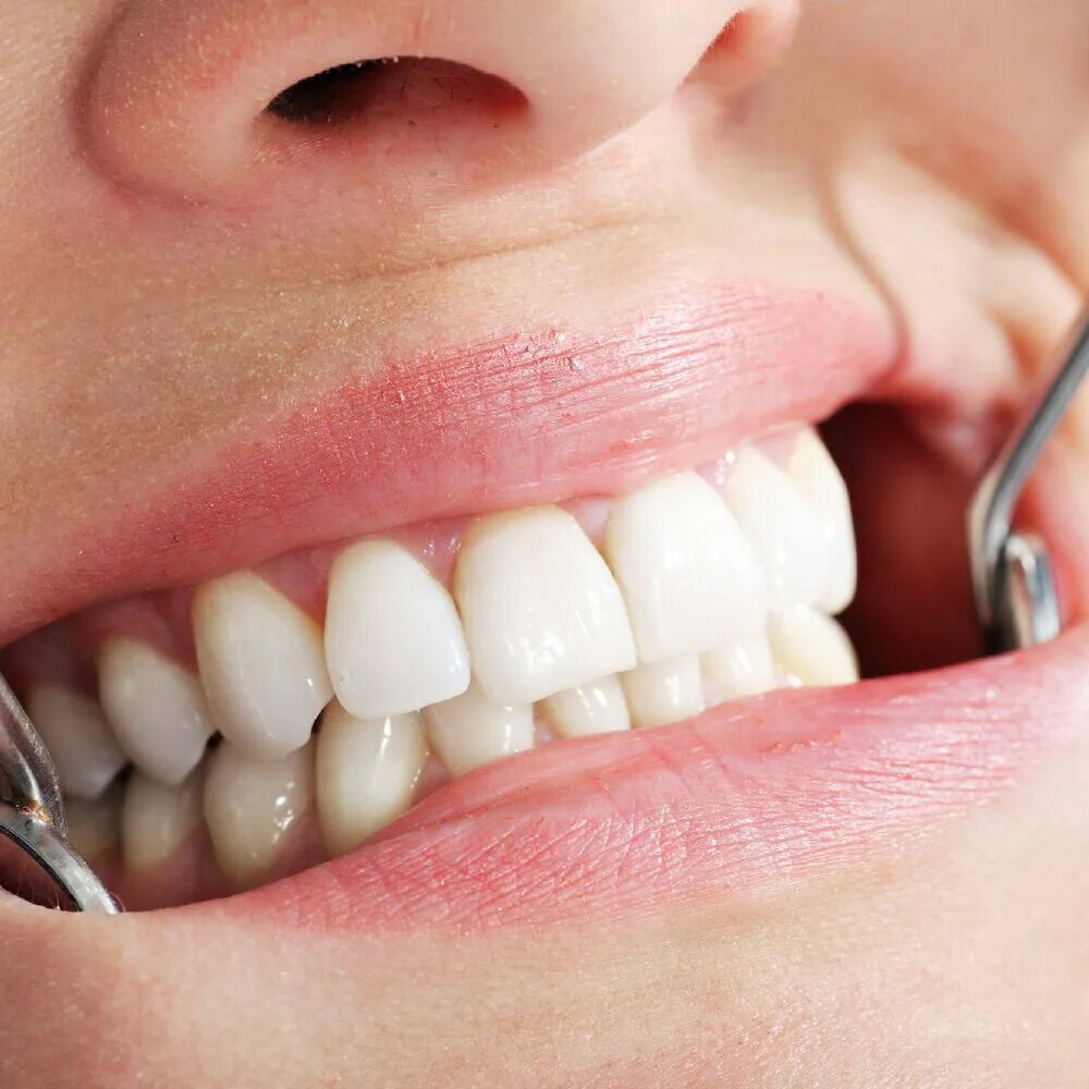 зубные протезы калуга