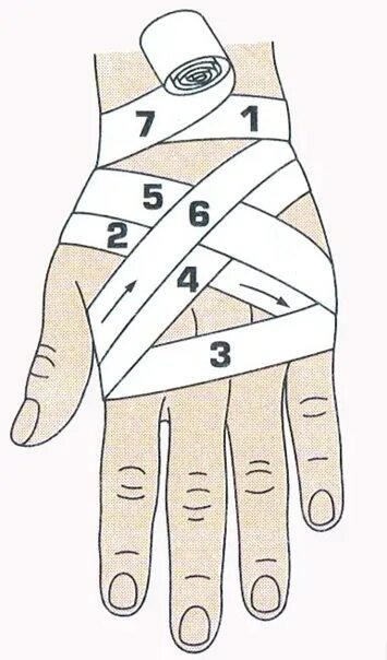 Техника наложения повязки на кисть. Крестообразная (восьмиобразная) повязка. Восьмиобразная повязка на лучезапястный сустав. Крестообразная (восьмиобразная) повязка на кисть. Крестообразная повязка на кисть алгоритм.