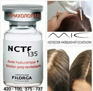 Мезотерапия киров
