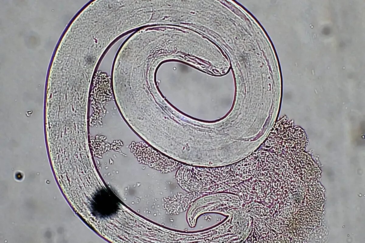 Вид трихинелла Спиралис. Трихинелла спиральная - Trichinella spiralis. Трихинелла Спиралис в микроскопе.