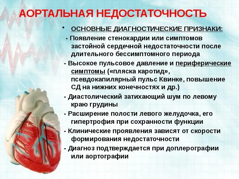 Ибс стенокардия инфаркт миокарда. Сердце при стенокардии. Аортальный порок сердца симптомы. Стеноз венечных артерий. Экг критерии стенокардии принцметала.