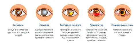 Отзывы после лечения катаракты