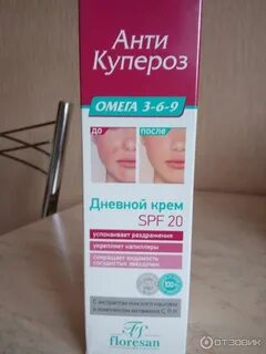 Антикупероз