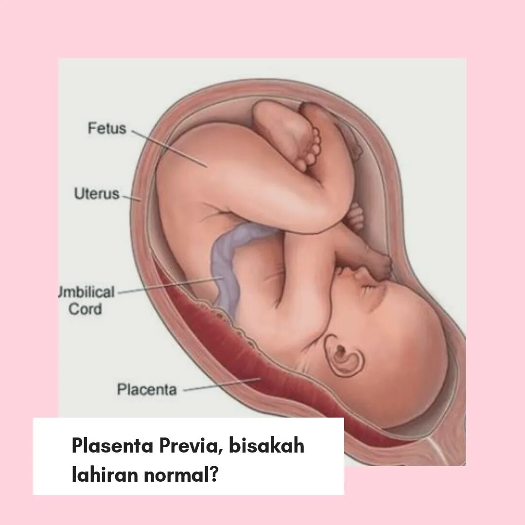 Где находится роды. Ребенок с пуповиной и плацентой. Плацента матка пуповина.