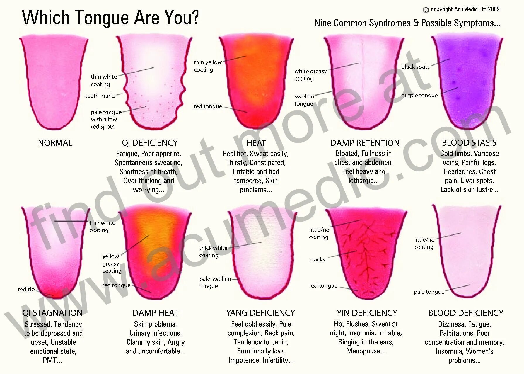 Как определить больной орган. Болезни по языку определить. Заболевания по цвету языка.