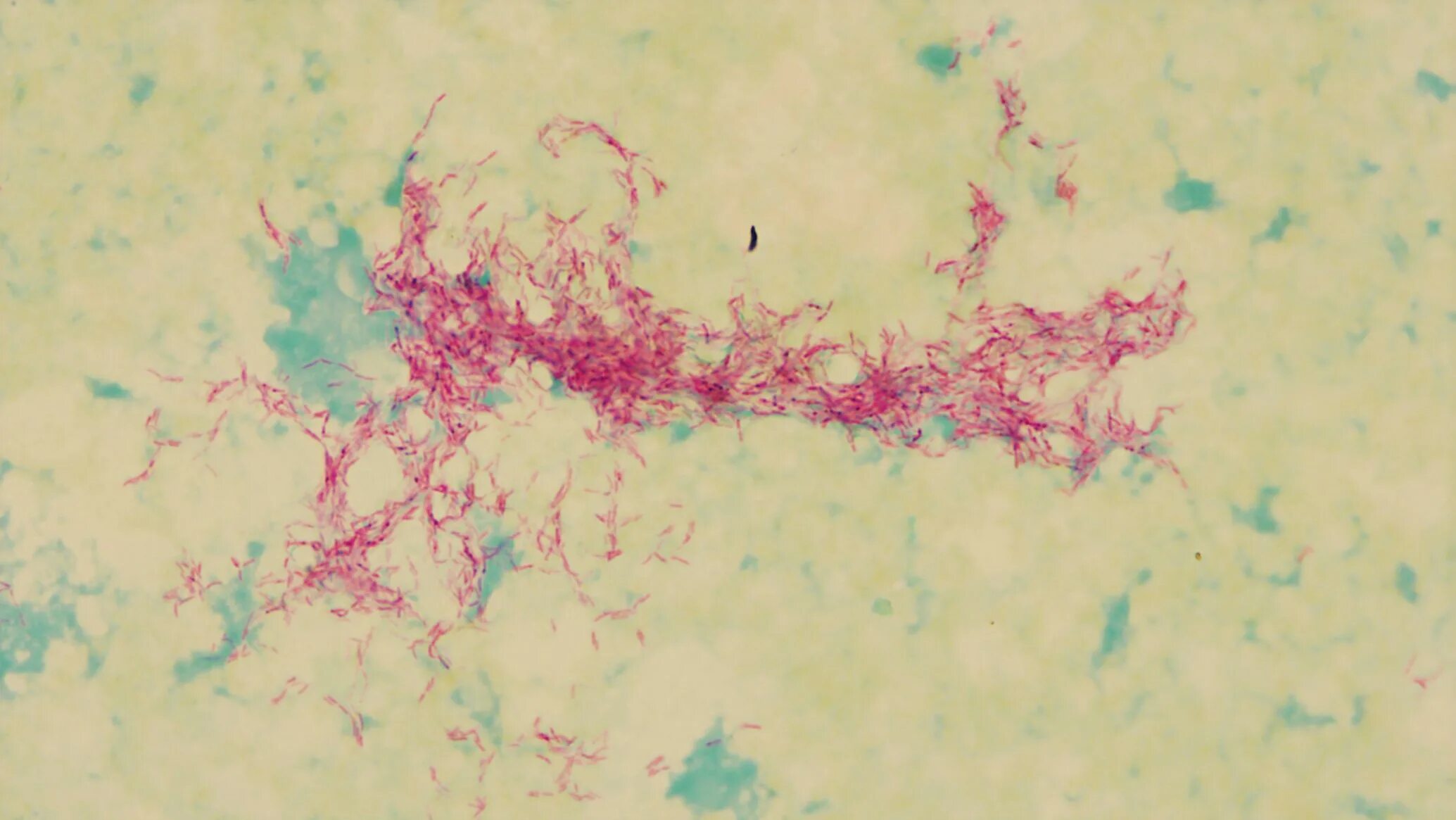 Mycobacterium tuberculosis complex. Микобактерии туберкулеза микроскопия. mycobacterium tuberculosis в микроскопе. микобактерии туберкулеза под микроскопом. микобактерии микробиология.