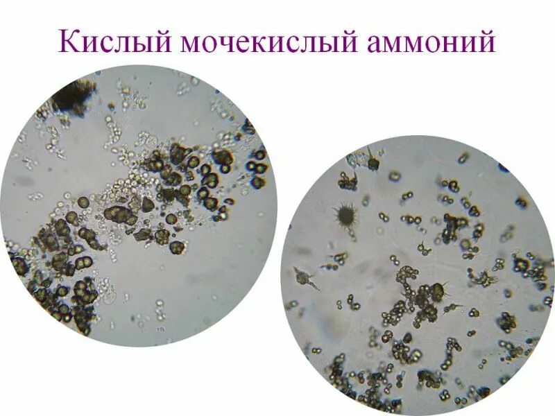 ФСВОК микроскопия осадка мочи. Нечипоренко микроскопия. Мочевая кислота микроскопия. Мочевой осадок микроскопия.