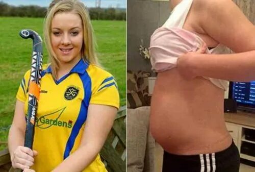 Красивая беременная девушка. Беременная девушка. Девушка оказалась беременна. Беременный живот. Обсуждение беременной подросток.