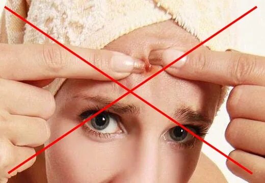 Почему нельзя давить на лице. Почему нельзя давить на лице