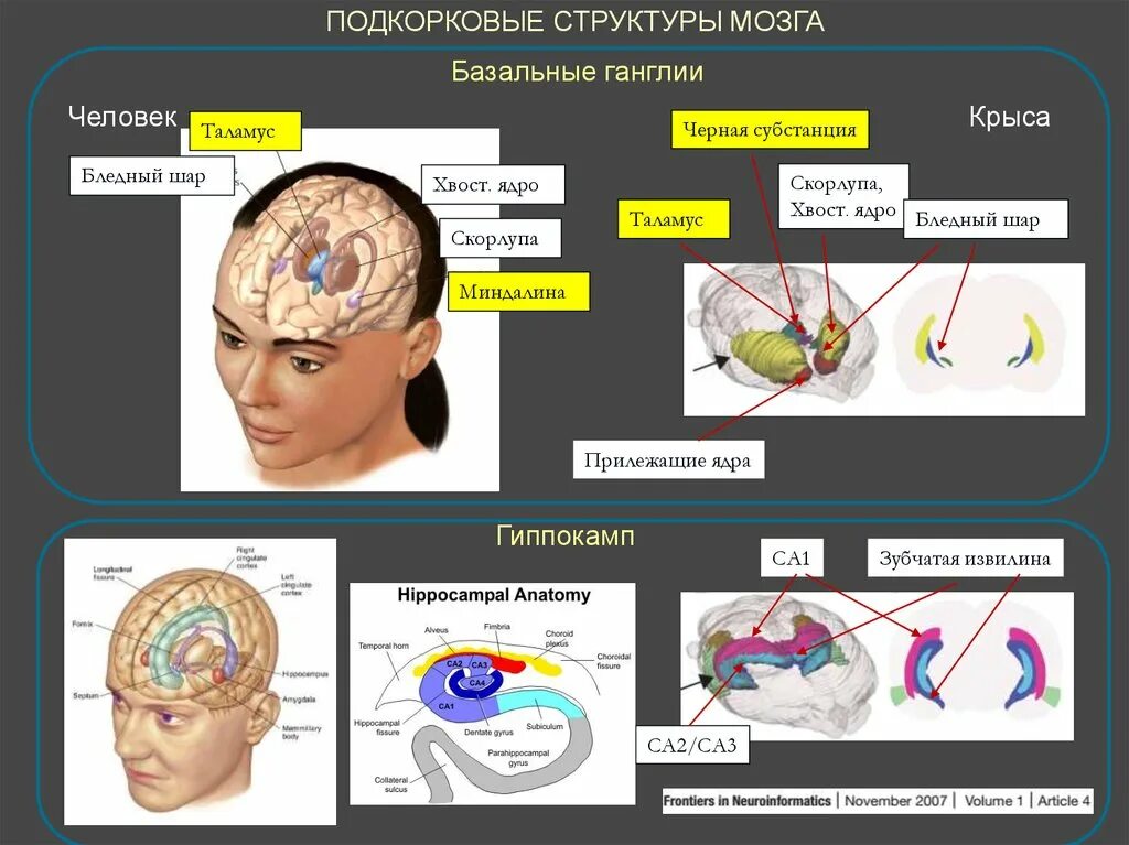 Подкорковые поражения мозга. Подкорковые структуры мозга. Базальные структуры мозга. Бледный шар мозга. Прилежащее ядро мозга.