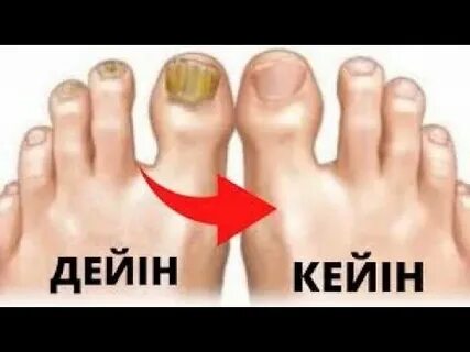 Мас әйел сорды