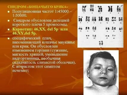 Аномалия аутосомных