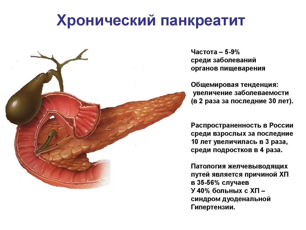 Хронический панкреатит симптомы у мужчин. Болезнь поджелудочной железы панкреатит. болезнь хронический панкреатит поджелудочной железы. патология хронического панкреатита. панкреатин болезнь поджелудочной железы.