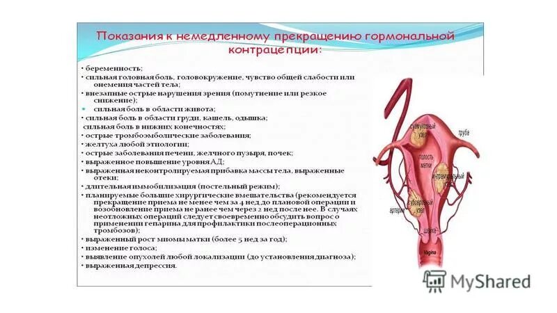 Крови после установки спирали мирена