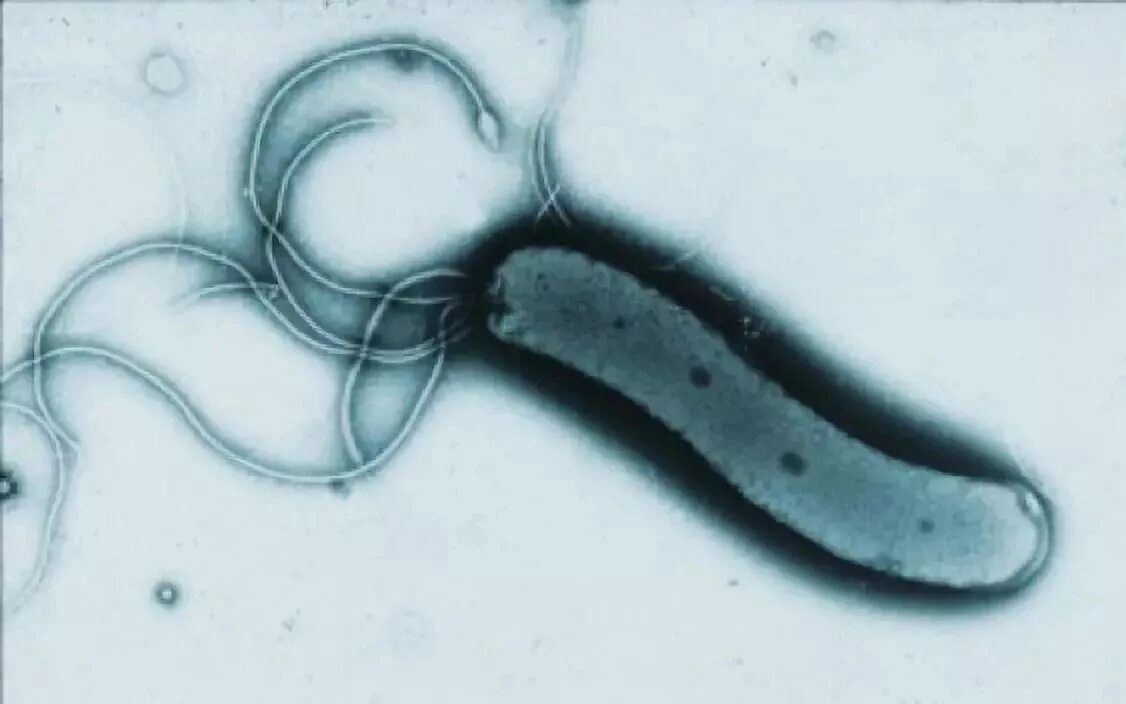 Бактерия хеликобактер пилори. Бактерия хеликобактер пилори под микроскопом. Helicobacter pylori под микроскопом. Бактерия Helicobacter pylori рисунок.