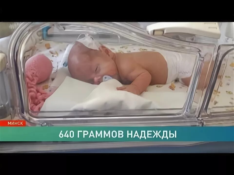 Как выглядит ребенок 500 грамм До и после