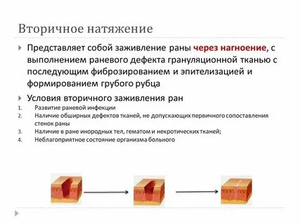 Через сколько заживает ранка
