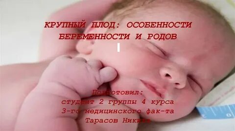 Крупный плод при беременности