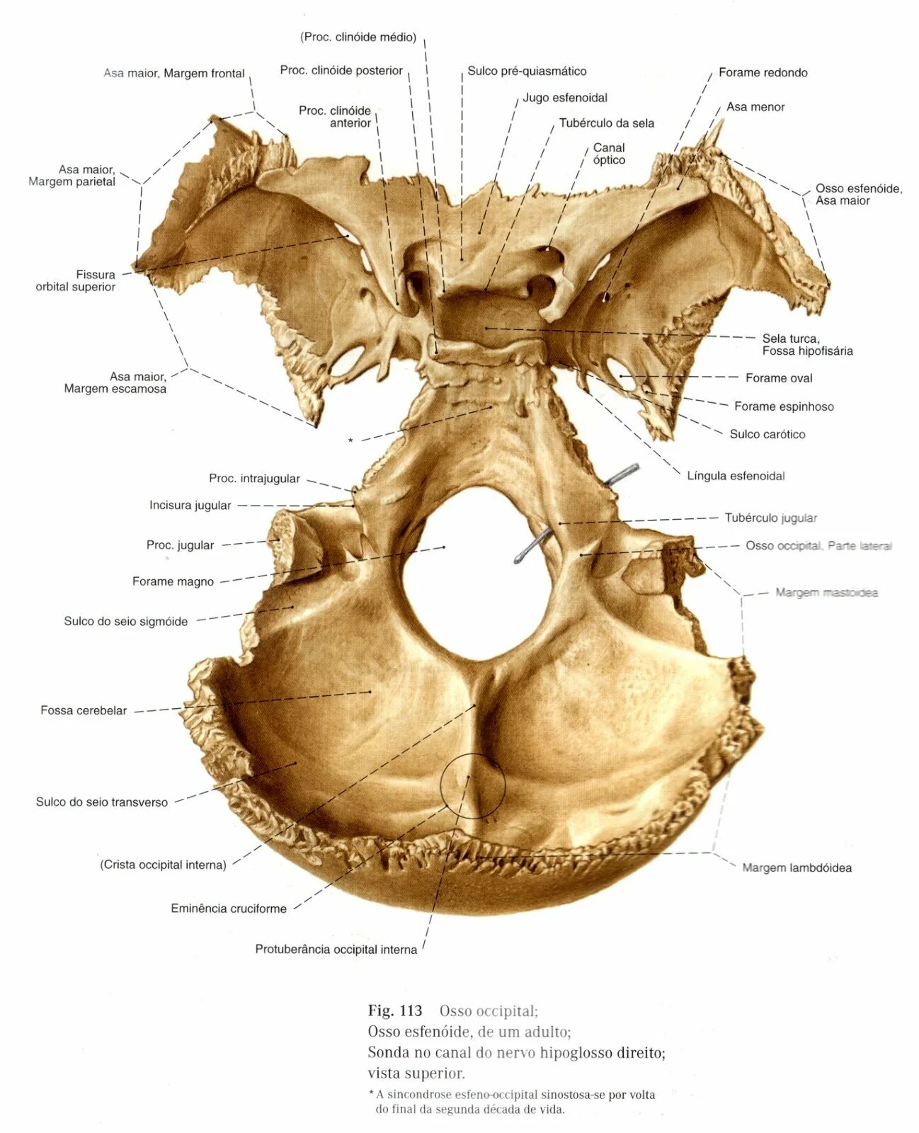 Турецкие седло кость. Клиновидная и затылочная кость анатомия. Клиновидная кость анатомия строение. Клиновидная кость черепа. Клиновидная кость черепа строение.