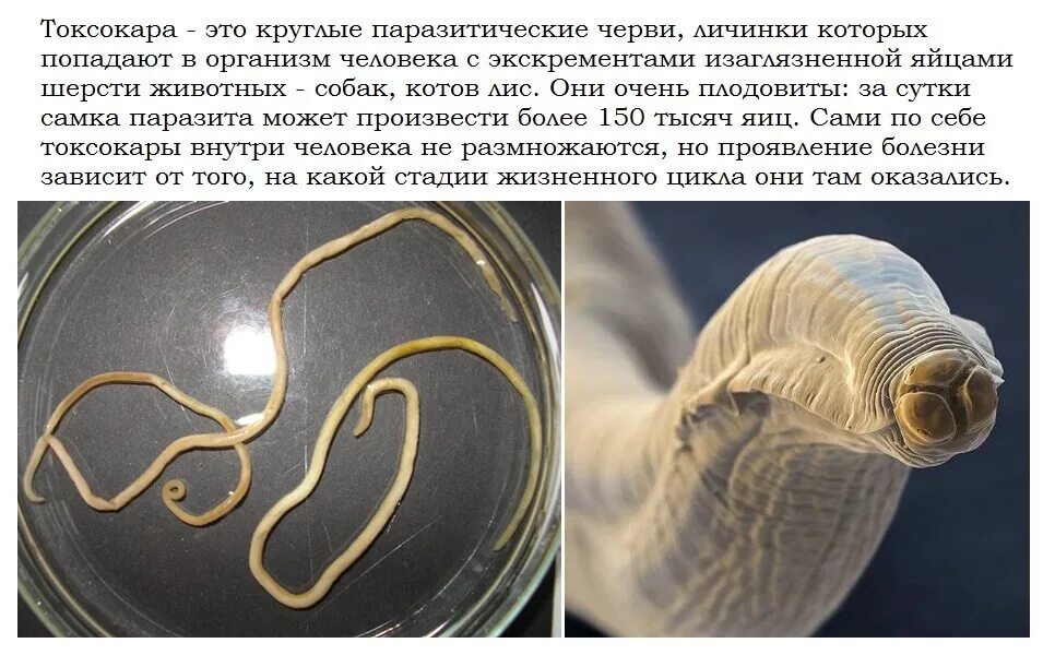 Токсокары у детей симптомы. Токсокары у детей симптомы