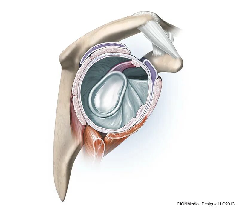 Гленоид плечевого сустава. Разрыв суставной губы гленоида плечевого сустава. Губа гленоида плечевого сустава. Шов суставной губы плечевого сустава.