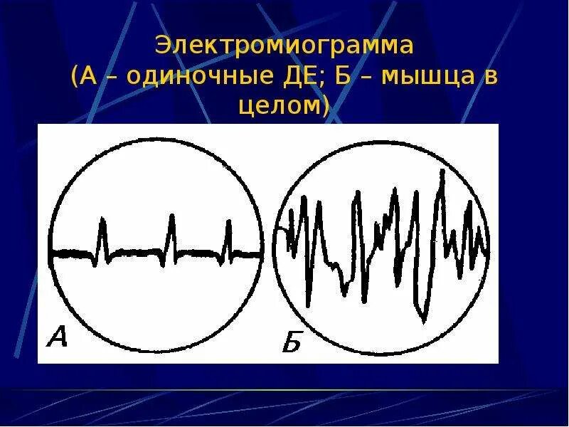 Электромиограмма. Электромиограмма физиология. Простая электромиограмма. Спектр электромиограммы. Передача пд