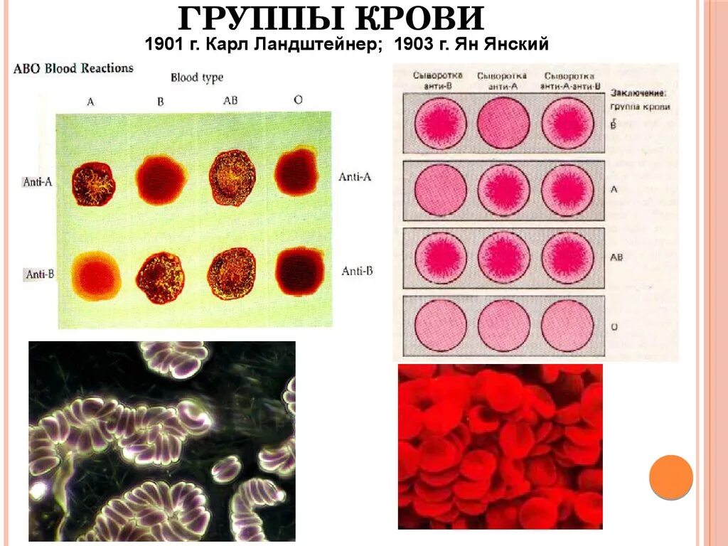 Кровь разного цвета. 1901 Ландштейнер агглютинация. Группа крови. Группы крови человека. Кровь группы крови.