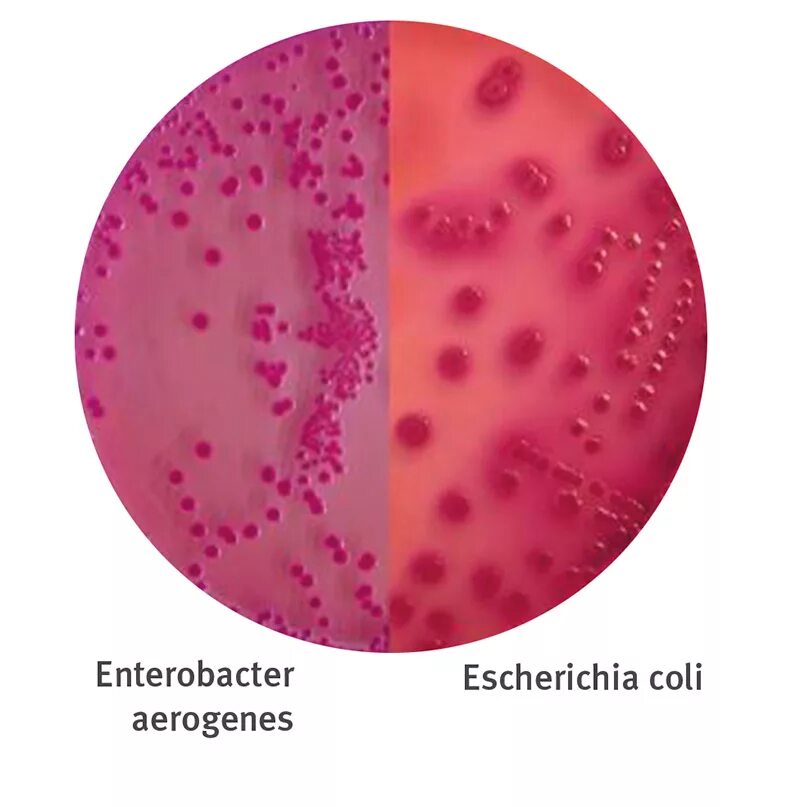 Энтеробактер аэрогенес. Энтеробактер Аэрогенез микробиология. Enterobacter aerogenes Эндо. Энтеробактерии микробиология род энтеробактер. Enterobacter cloacae что это