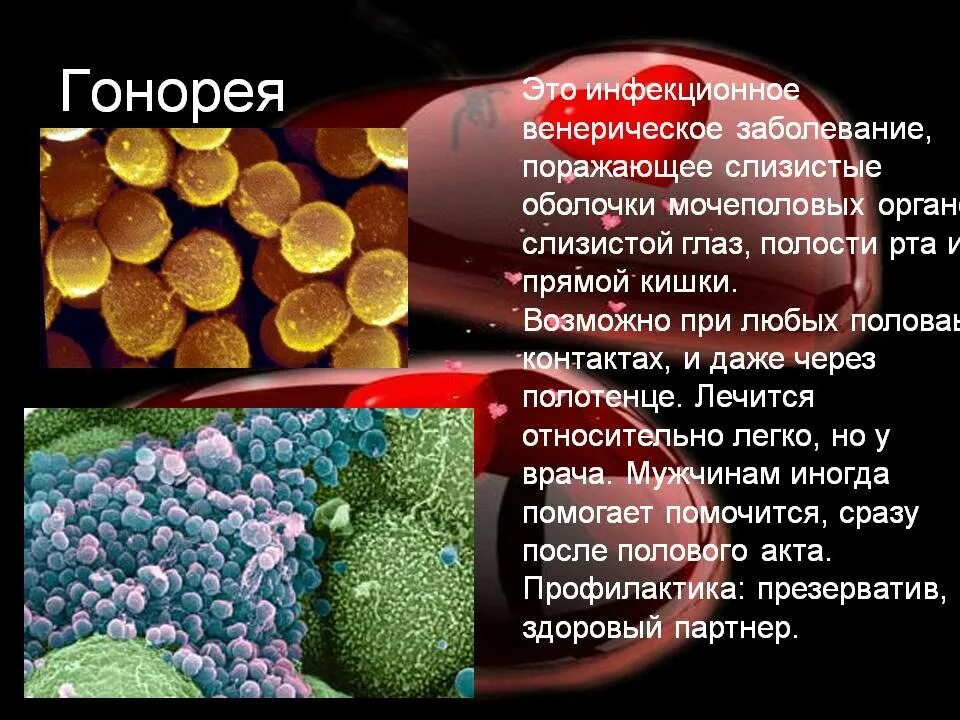 Сколько лечится гонорея. Венерические заболевания презентация. Венерические заболевания гонорея. Невенеричечкие заболевания.