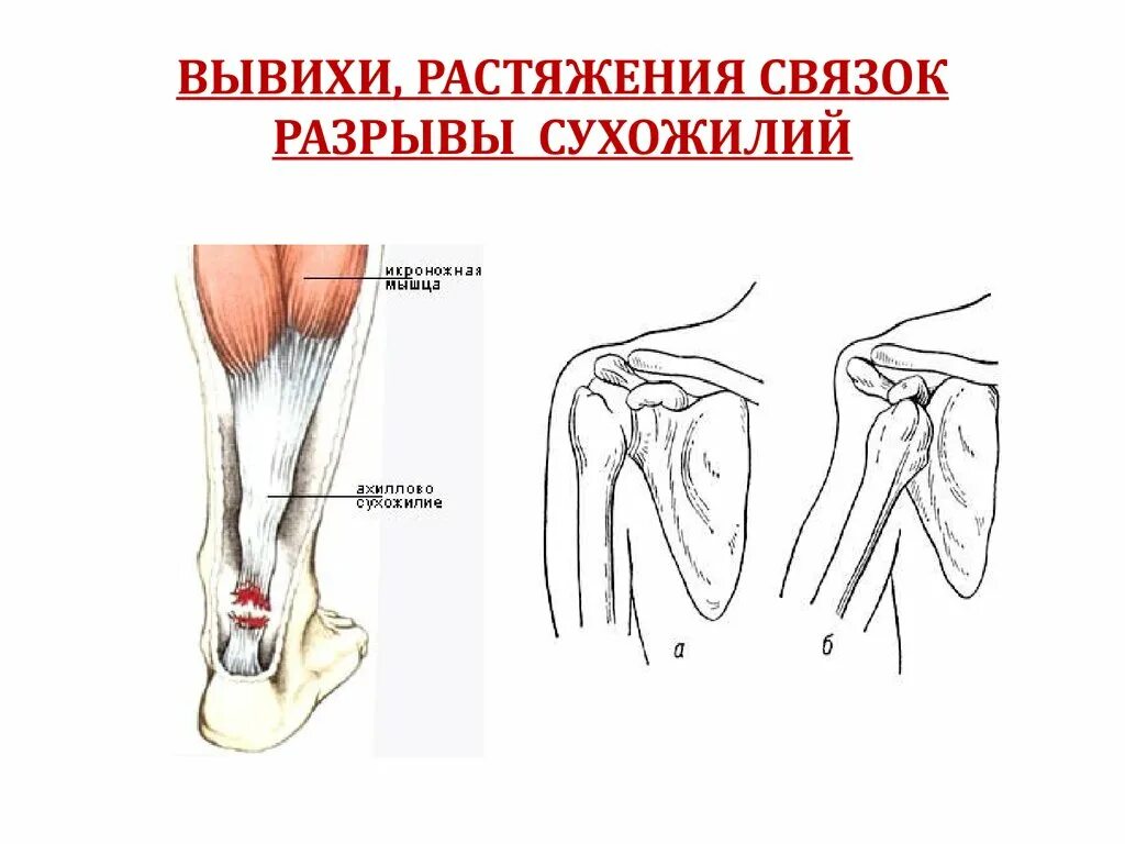 Разрыв и растяжение