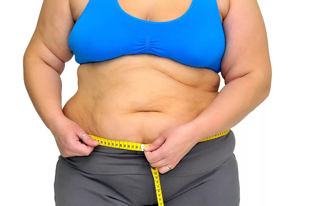 Толстое тело. Ожирение. Лишний вес. Ожирение у женщин. Избыточный вес.