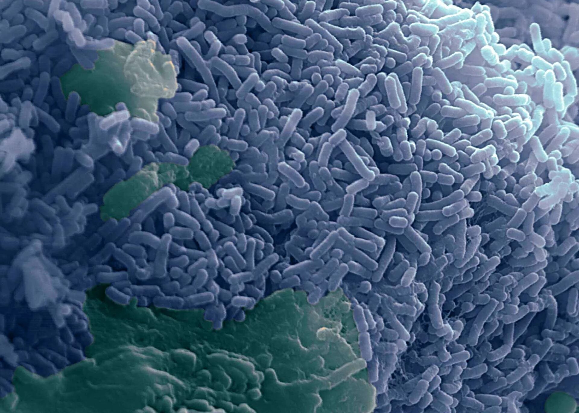 Рубцовые бактерии. Лактобациллы бактерии. Молочнокислые бактерии лактобациллы. Lactobacillus Acidophilus в микроскопе. Кисломолочные бактерии лактобацилус.