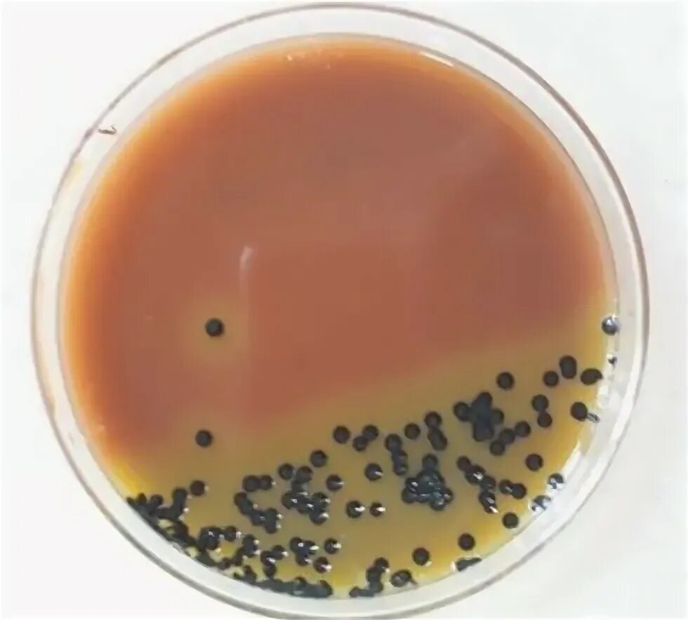 Spp salmonella spp shigella spp