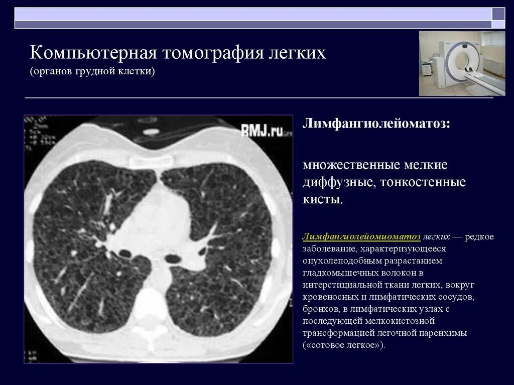 Уменьшение после кт