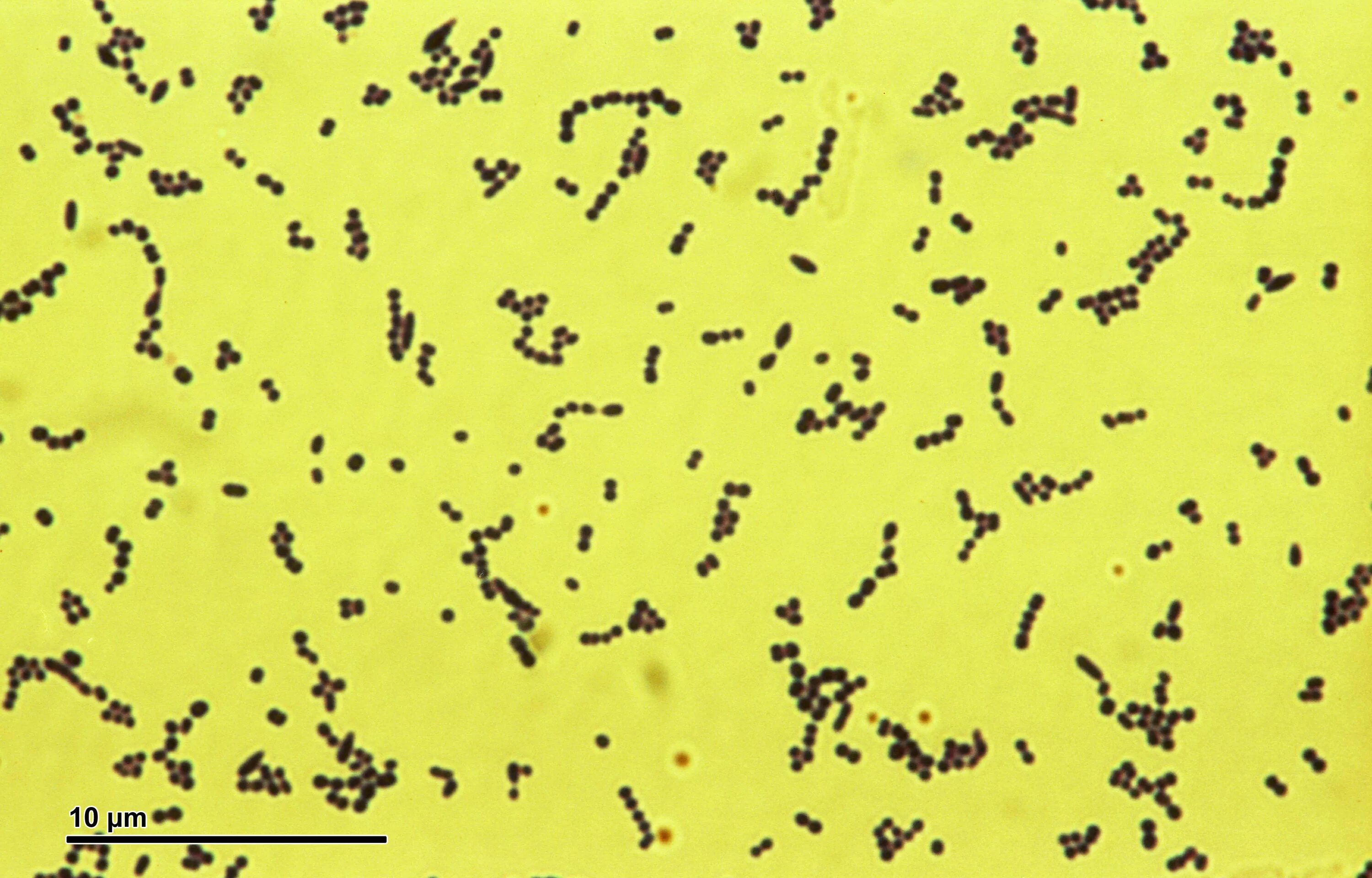 Peptostreptococcus. Стрептококки вириданс под микроскопом.