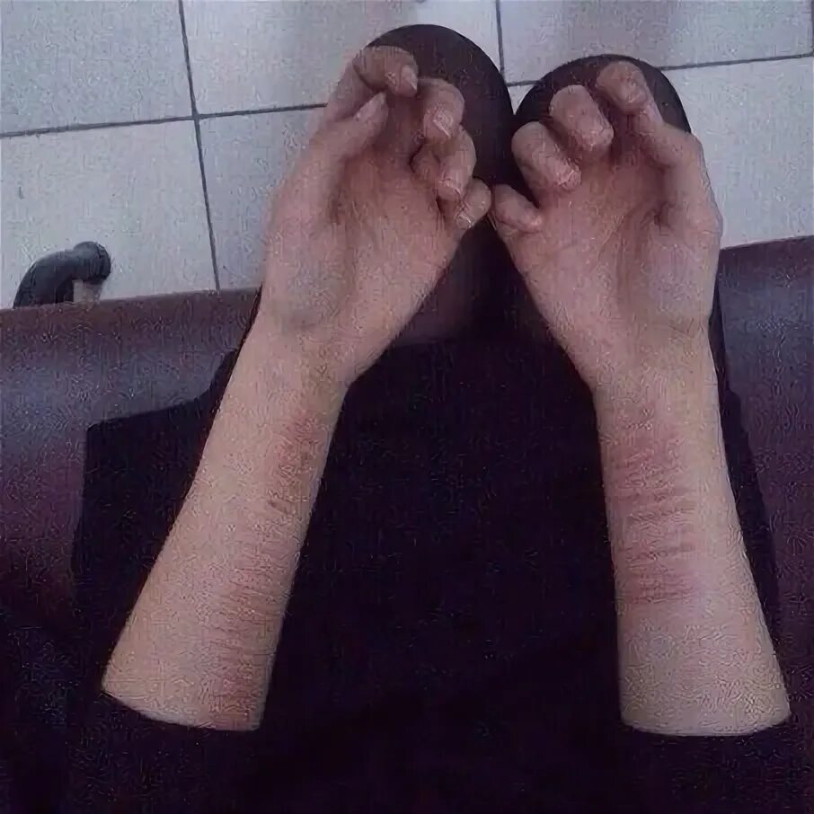 Как выглядят резанные руки Very tempting for my same arm (left) and location Tattoo over scar, Arm cover up