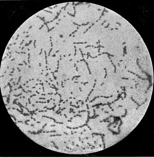 Streptococcus thermophilus. Стрептококк микроскопия. streptococcus equi мытный стрептококк. молочнокислый стрептококк микроскопия. термофильный стрептококк микроскопия.