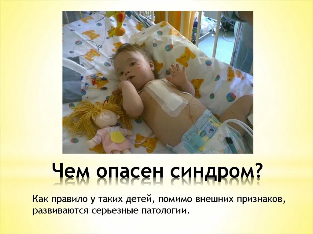 Что такое синдром опасна. Что такое синдром опасна