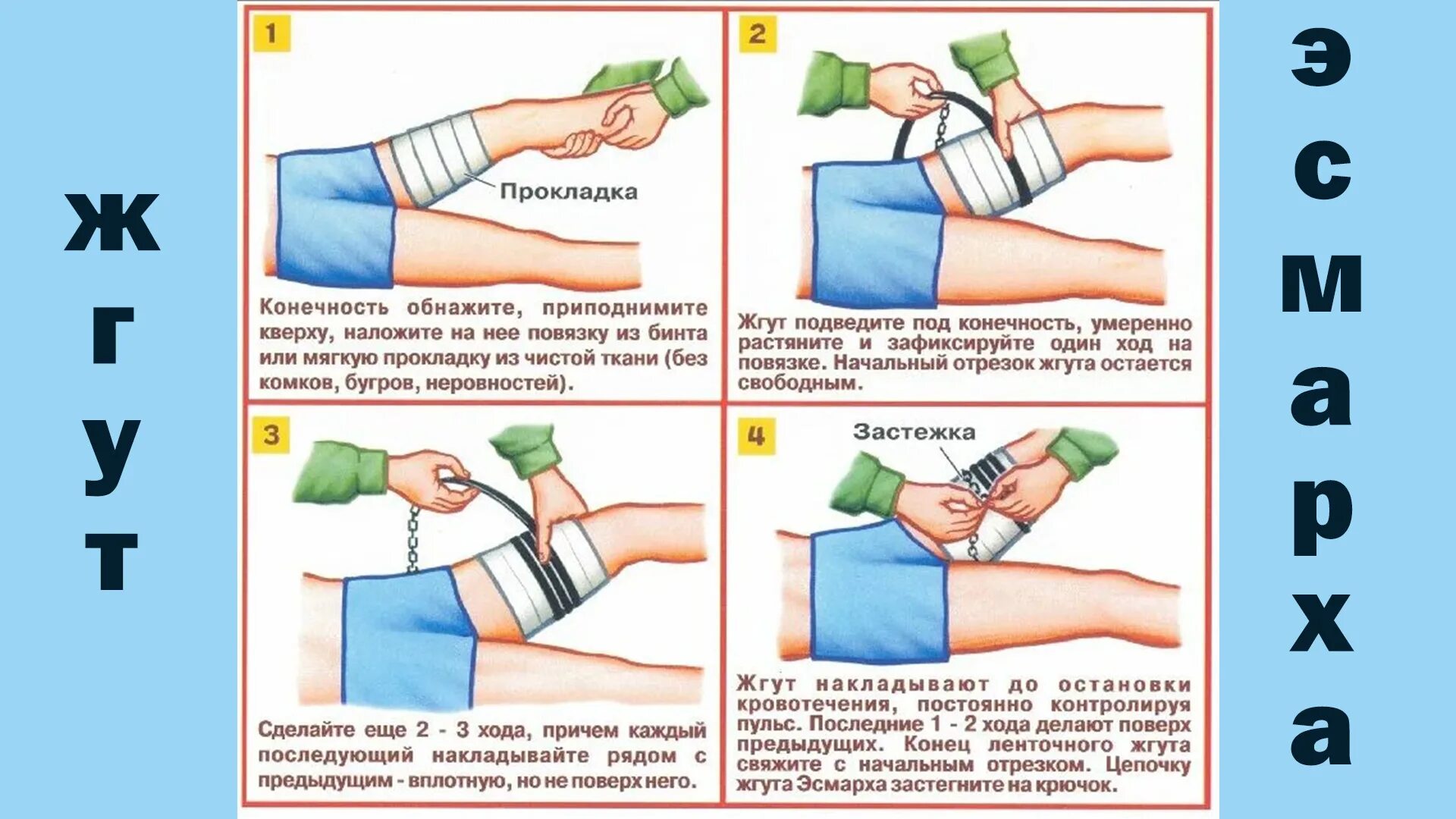 Конечность жгут после чего. При правильном наложении жгута. наложение жгута для остановки кровотечения. при правильном наложении жгута на конечность. наложение повязок и кровоостанавливающего жгута.