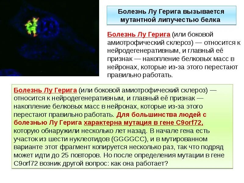 При расшифровке генома лосося было установлено 30. Болезнь Лу Герига. Болезнь Лу Герига известные больные. Боковой амиотрофический склероз. Боковой амиотрофический склероз симптомы.