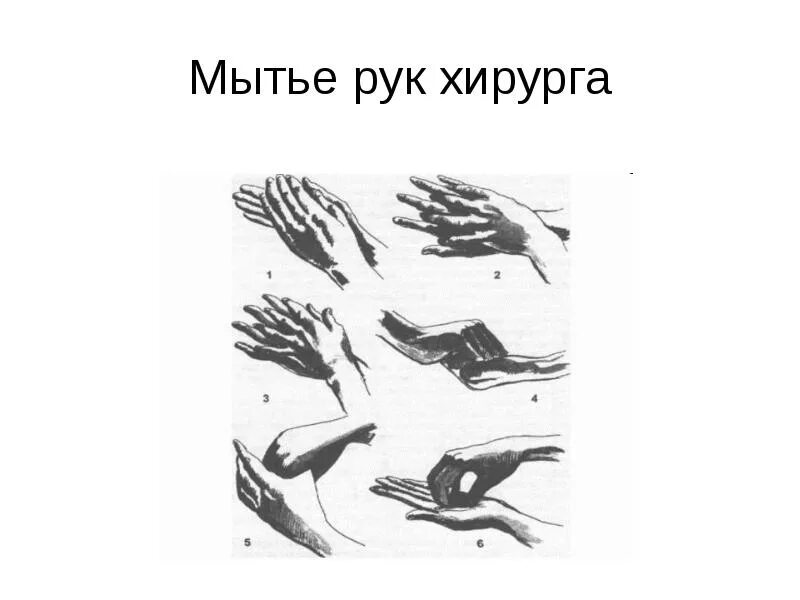 Спасокукоцкого кочергина обработка. Мытье рук в хирургии. Обработка рук хирурга. Мытье рук хирурга перед операцией. Способы мытья рук хирурга.