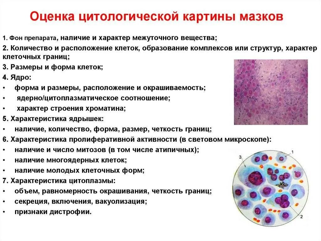 Как делают цитологию