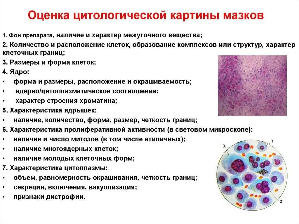 Физическое состояние клетки. Цитологическое исследование влагалищных мазков. Цитологическое исследование на атипичные клетки производят для. Микроскопическое исследование влагалищных мазков. Цитологическое исследование гистологическое исследование.